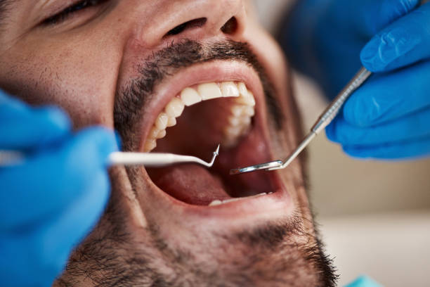 Best Broken or Cracked Tooth Emergency Dentist in Cresco, IA