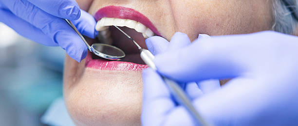 Best Emergency Dentist for Lost Fillings or Crowns in Cresco, IA